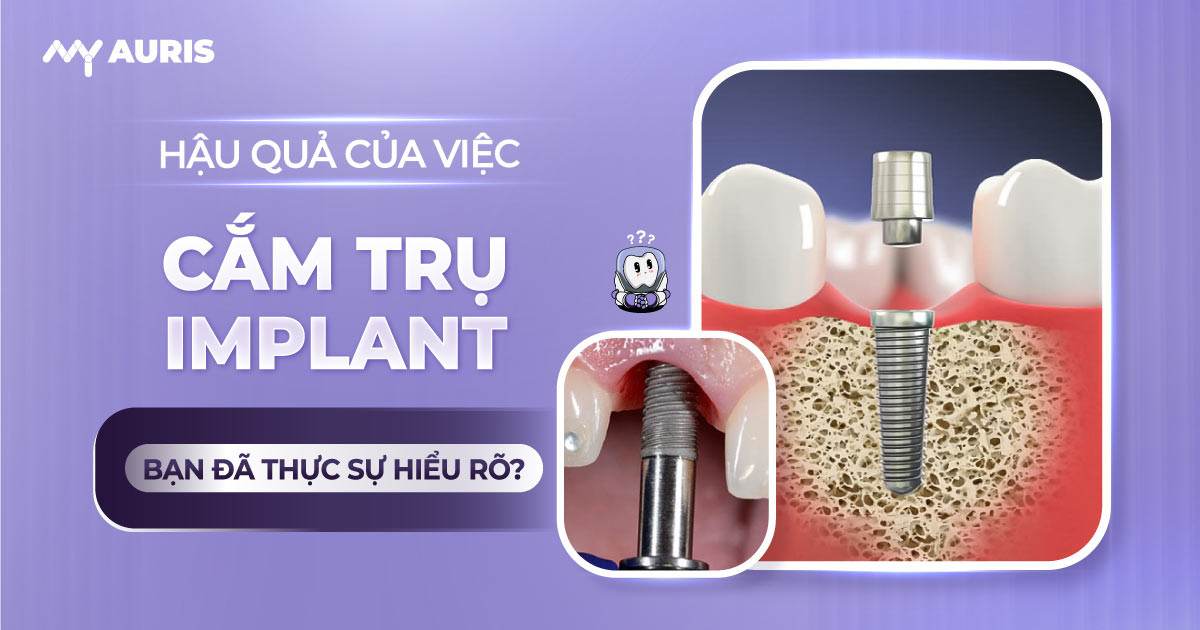 hau-qua-cua-viec-cam-tru-implant