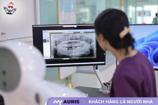 làm răng sứ sau bao lâu thì hết ê buốt