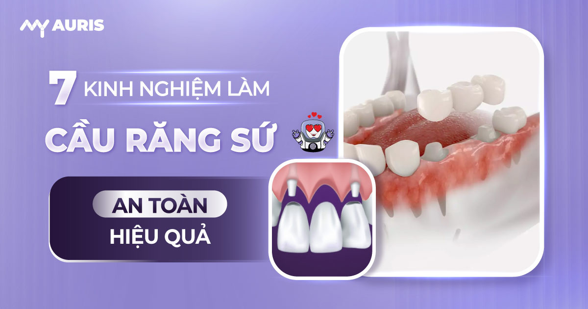 kinh nghiệm làm cầu răng sứ,cầu răng sứ nhảy