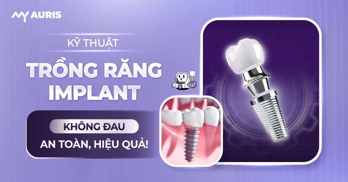 ky-thuat-trong-rang-implant