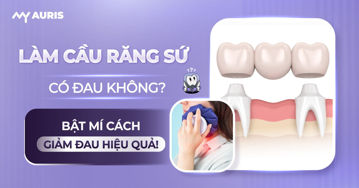 làm cầu răng sứ có đau không