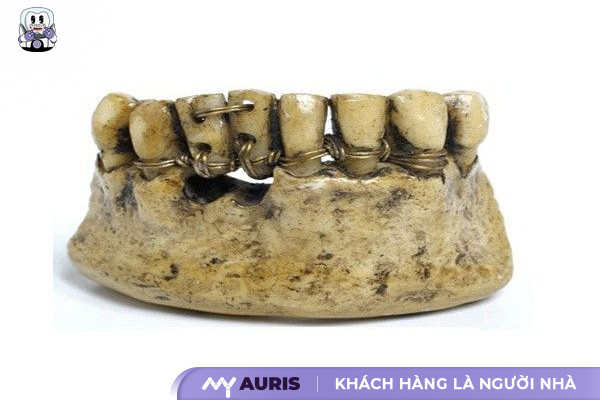 Niềng Răng Thời Cổ Đại
