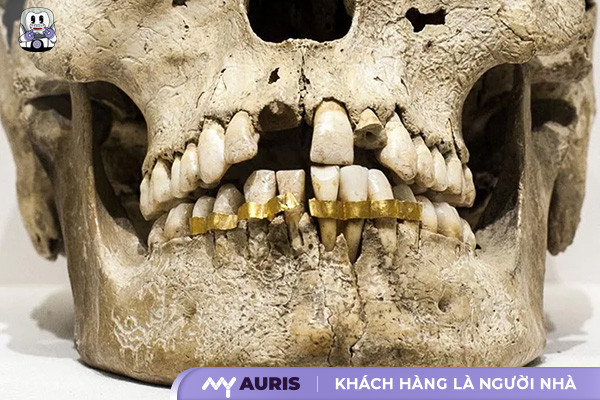 lich-su-nieng-rang-221024-02