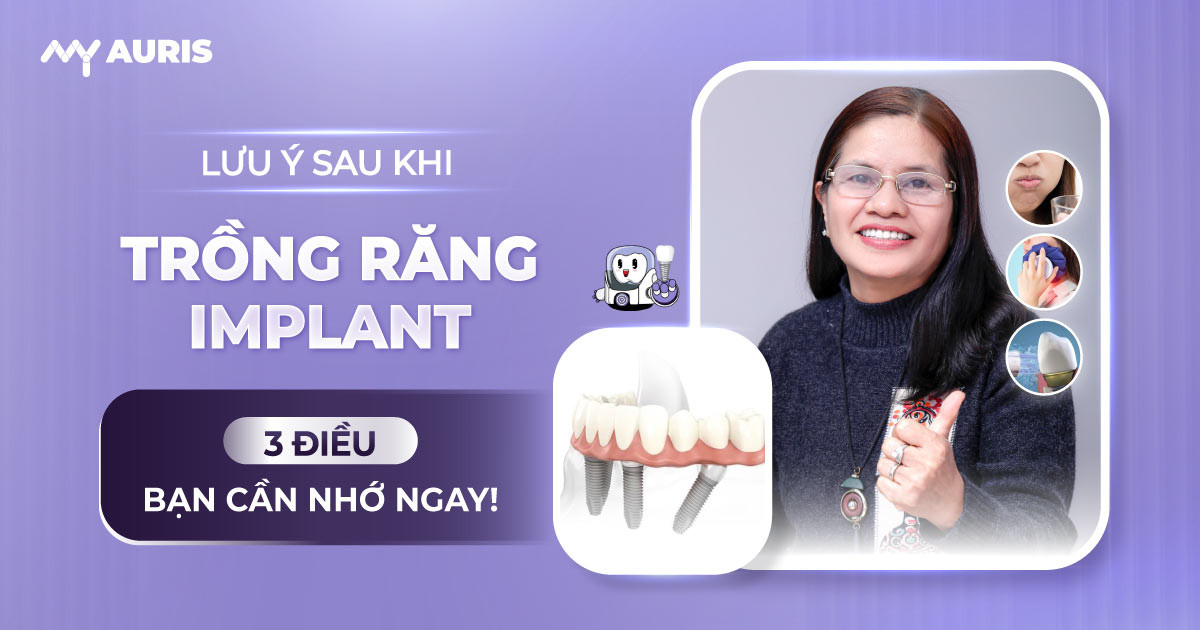 luu-y-sau-khi-trong-rang-implant