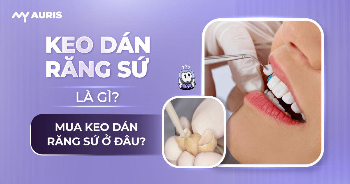 mua keo dán răng sứ ở đâu