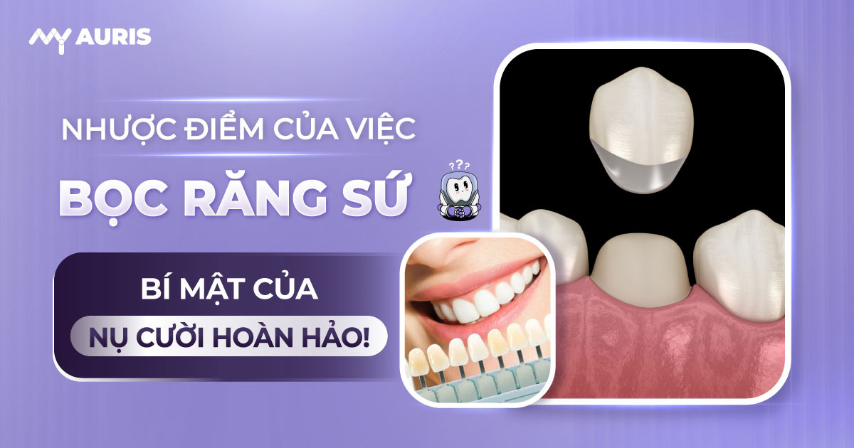 nhược điểm của việc bọc răng sứ