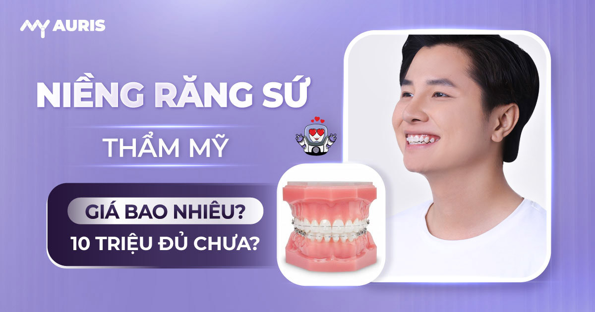 niềng răng sứ thẩm mỹ giá bao nhiêu