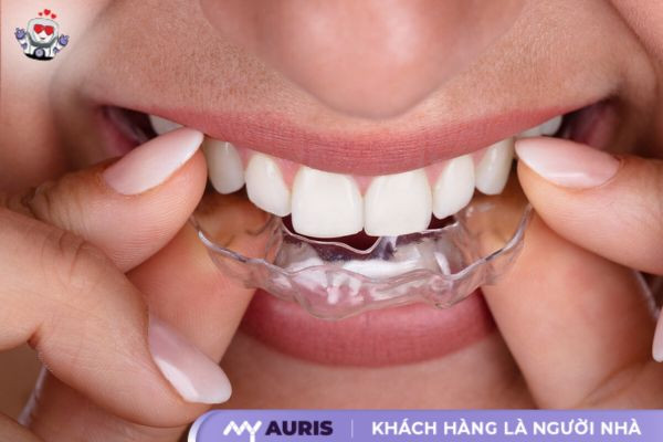 răng sứ cercon có mấy loại