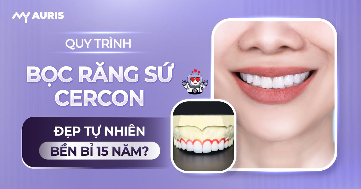 quy trình bọc răng sứ cercon