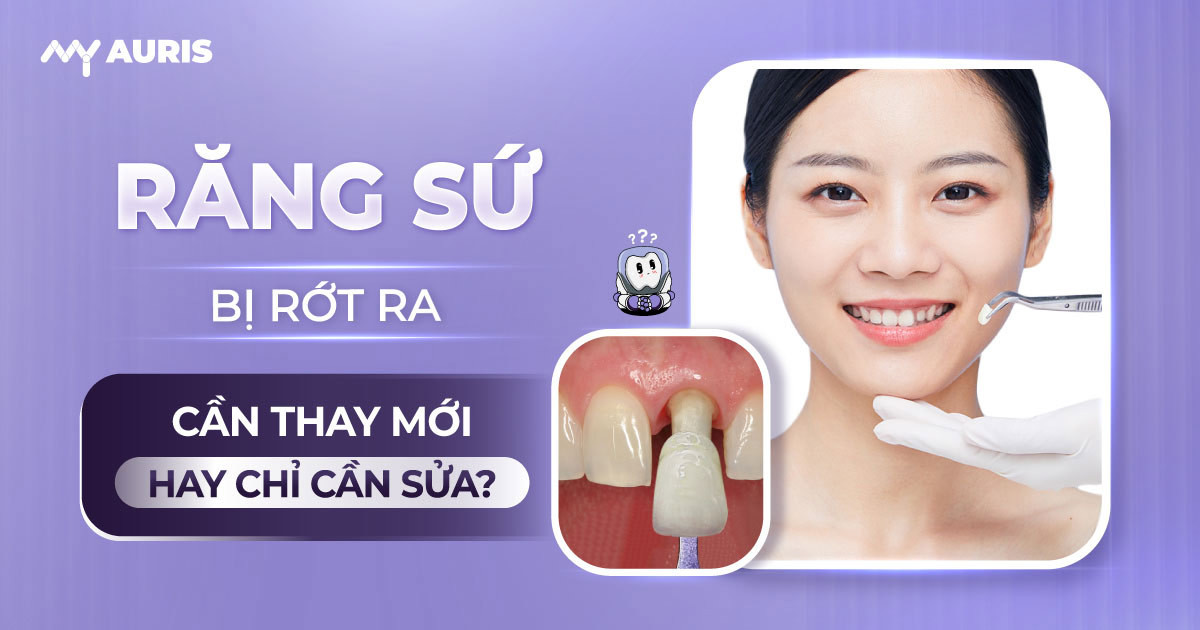 Răng sứ bị rớt ra