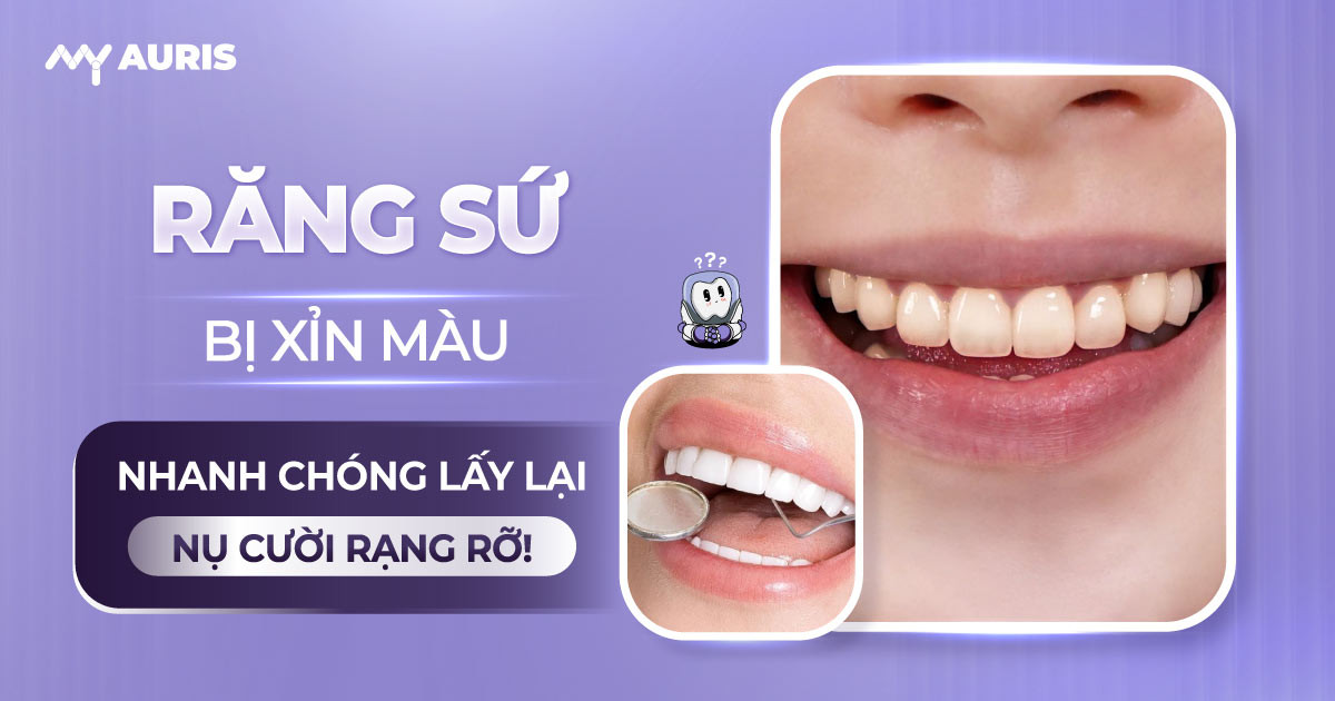 răng sứ bị xỉn màu