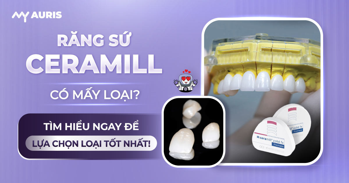 răng sứ Ceramill có mấy loại