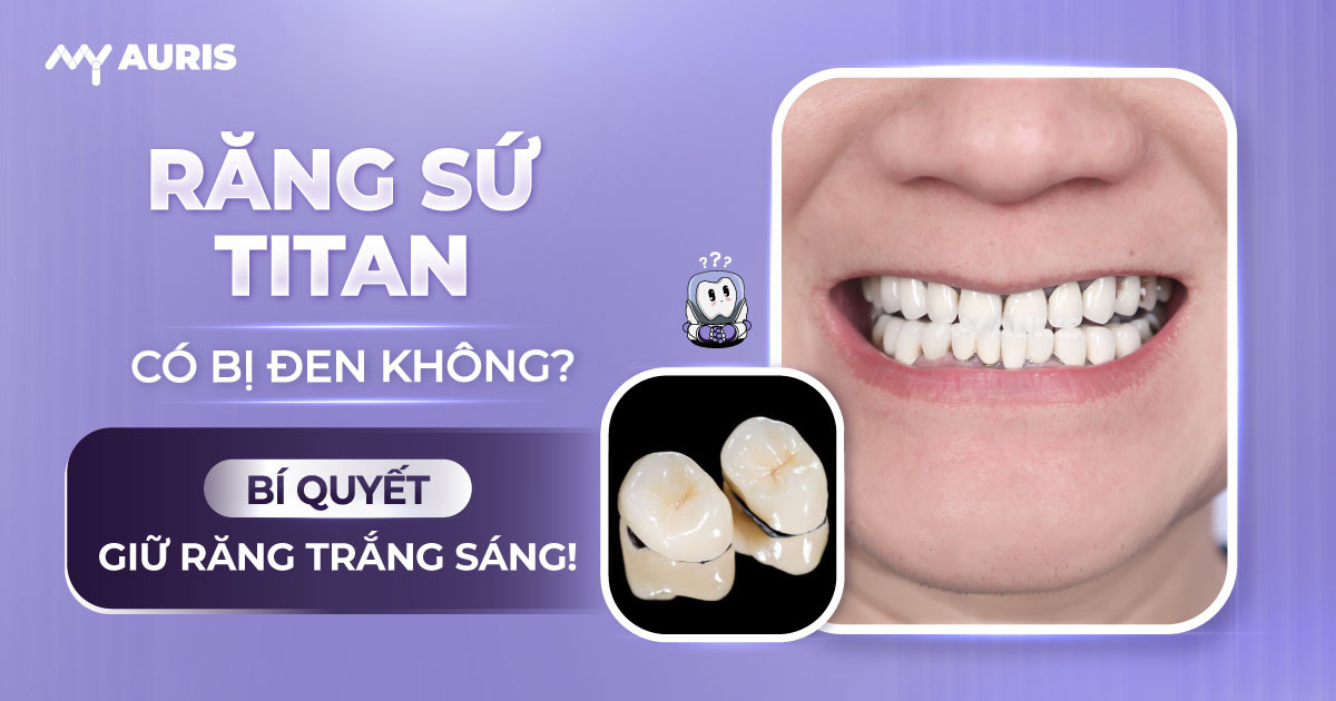 răng sứ titan có bị đen không, răng sứ titan có mấy loại, bọc răng sứ titan, răng sứ kim loại titan, răng sứ titan, răng sứ titan vita