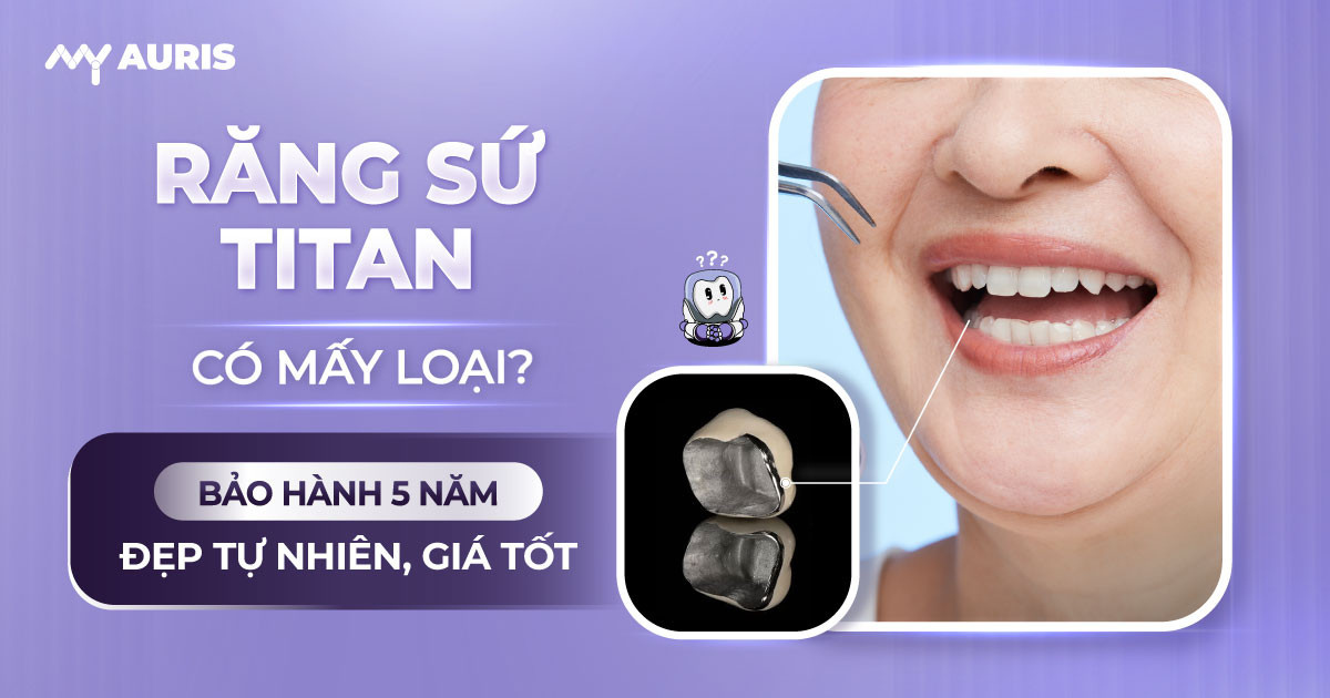 răng sứ titan có mấy loại ,bọc răng sứ titan,răng sứ kim loại titan,răng sứ titan,răng sứ titan vita