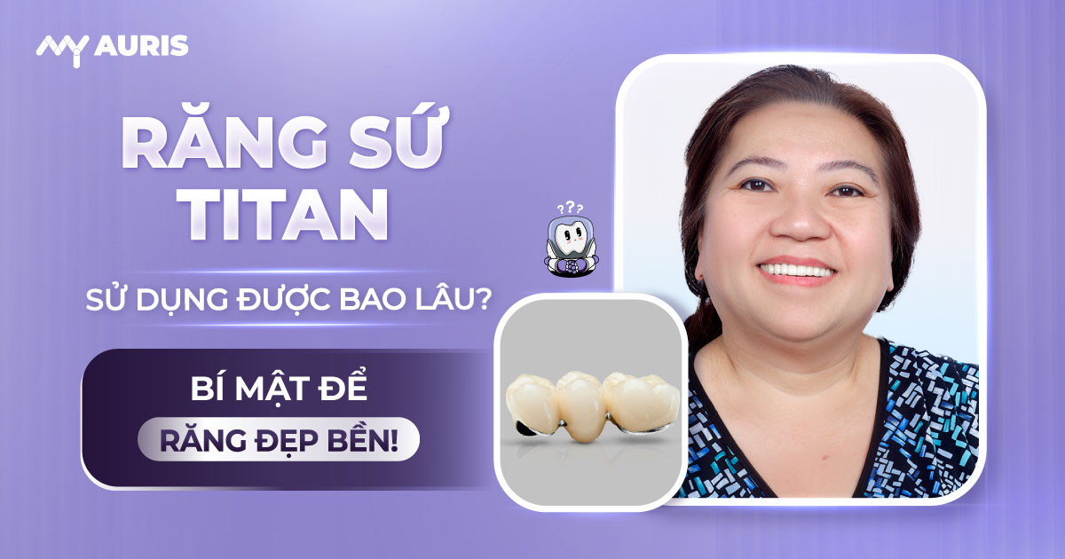 răng sứ titan sử dụng được bao lâu