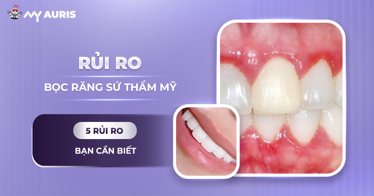 Bọc răng sứ thẩm mỹ có ảnh hưởng gì không