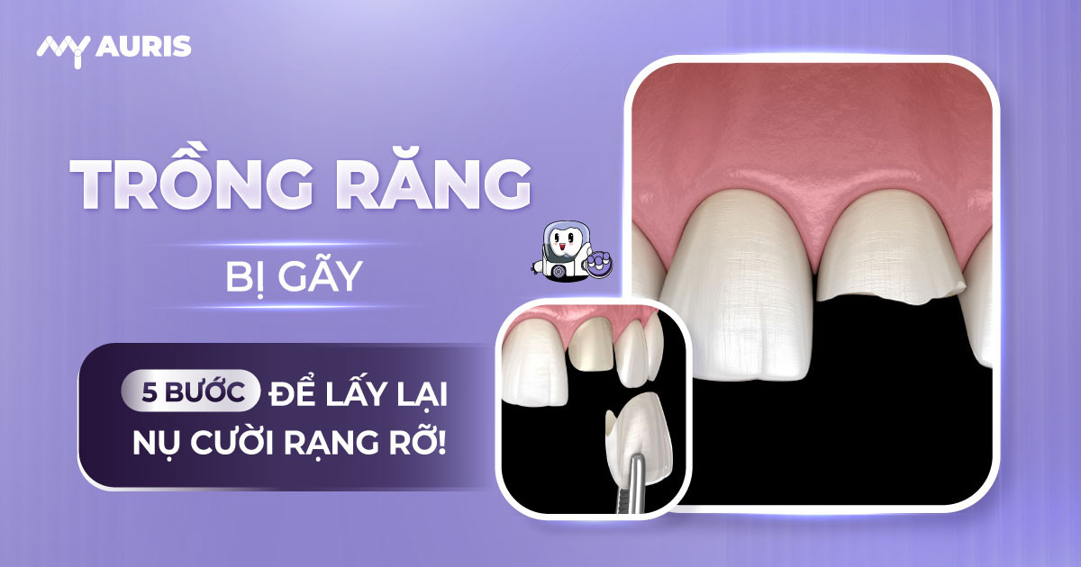 trồng răng bị gãy