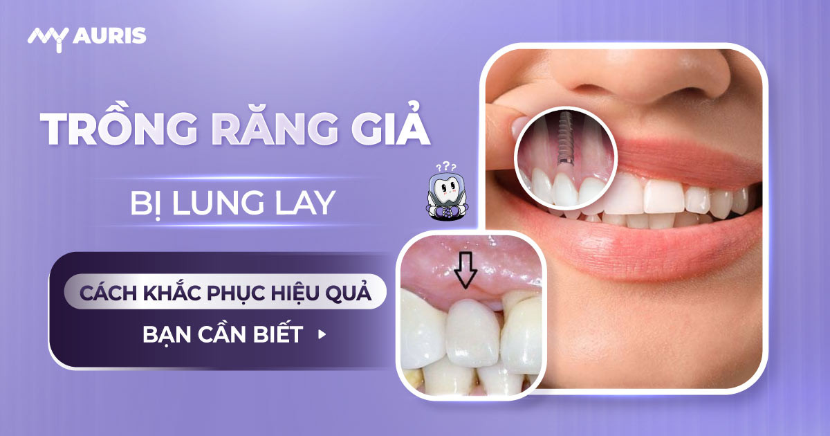 trồng răng giả bị lung lay