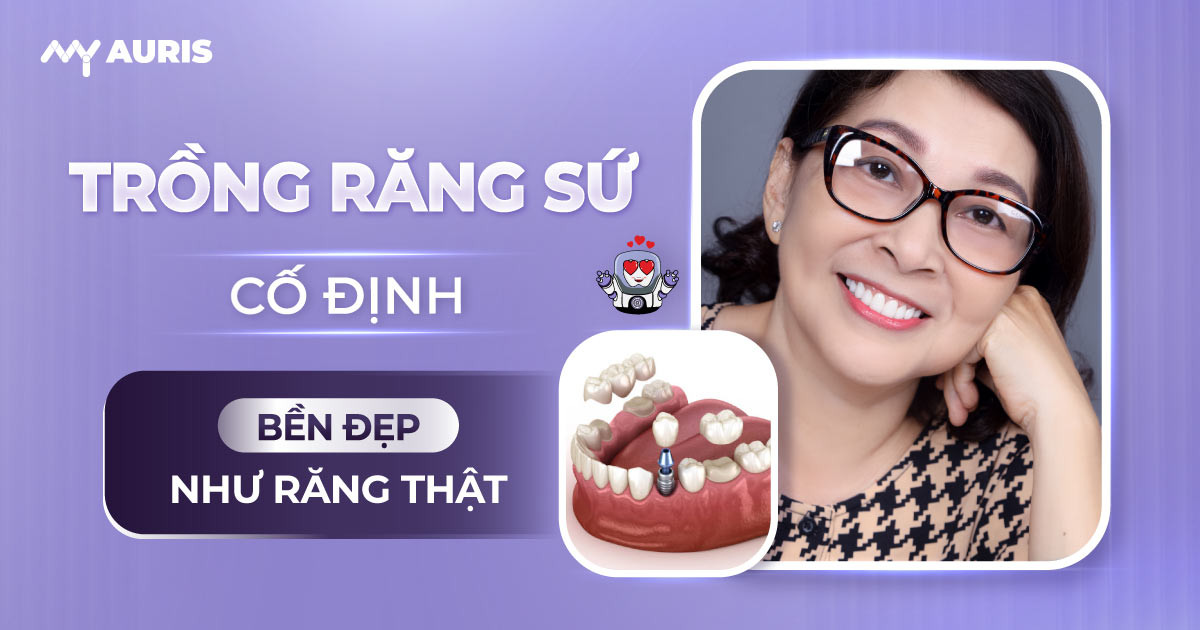 trong-rang-su-co-dinh-4-10-24