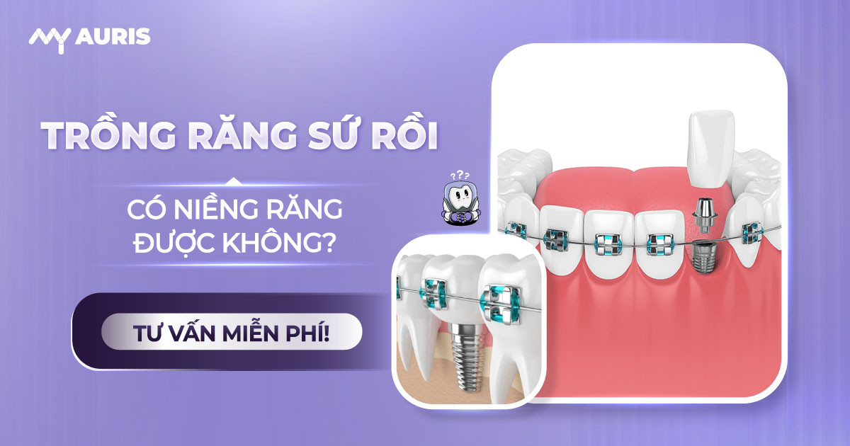 trong-rang-su-roi-co-nieng-rang-duoc-khong