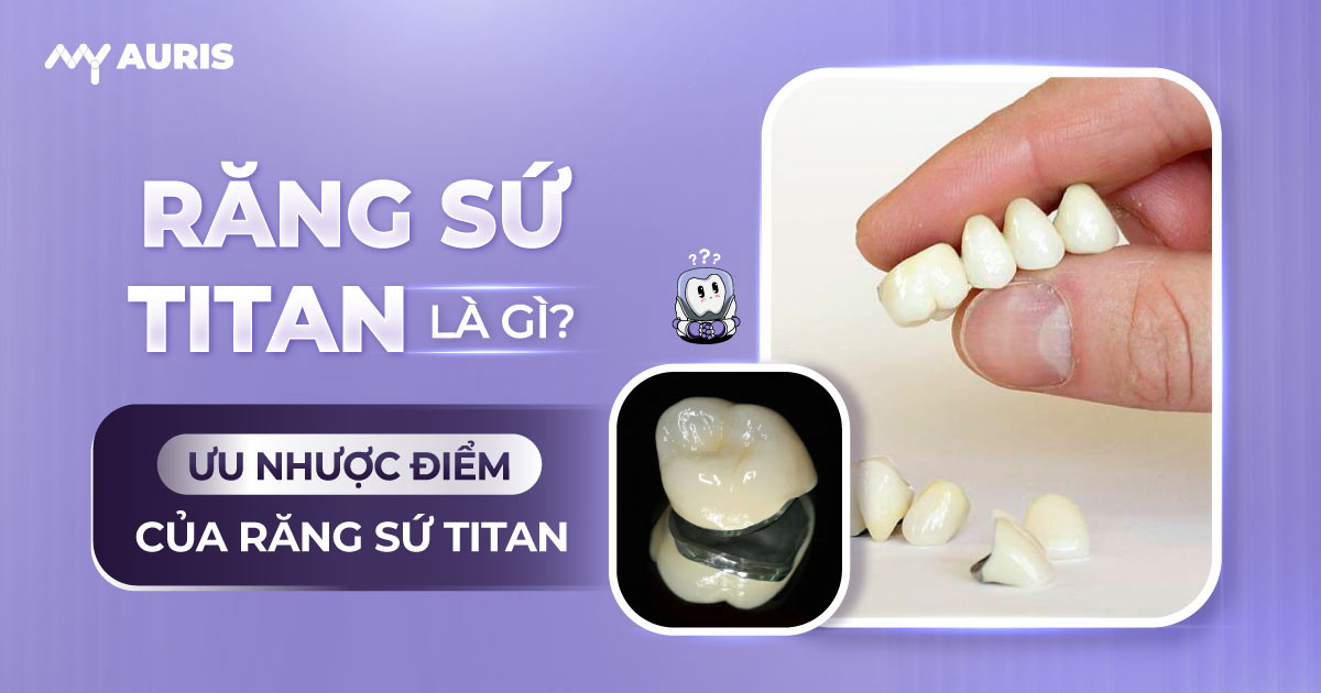 ưu nhược điểm của răng sứ titan,"nhược điểm của răng sứ titan,nhược điểm răng sứ titan