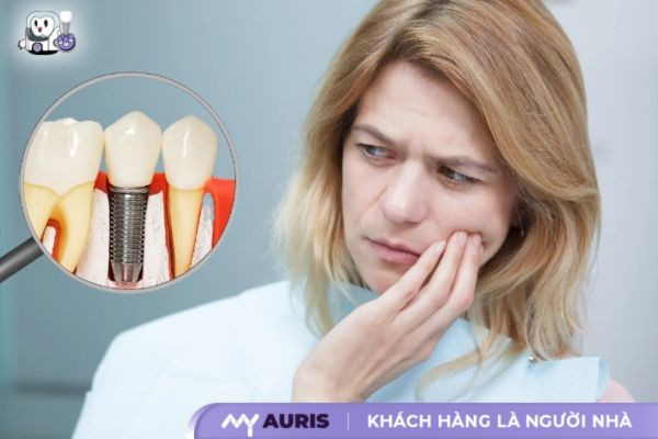 trồng răng implant bị lung lay