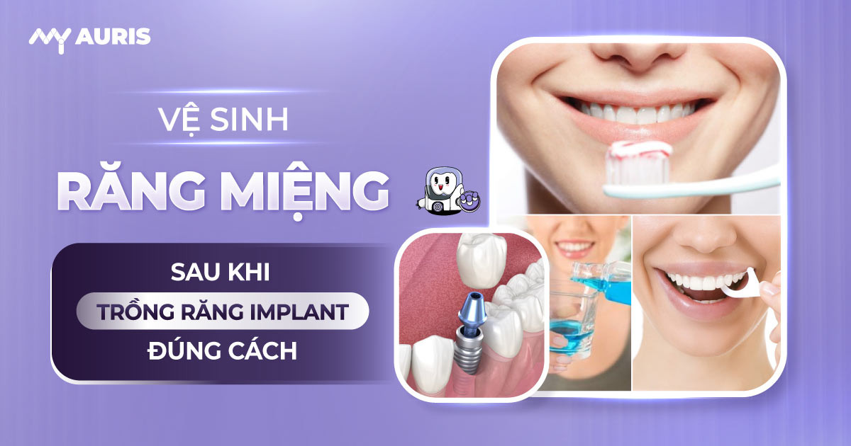 ve-sinh-rang-mieng-sau-khi-trong-implant