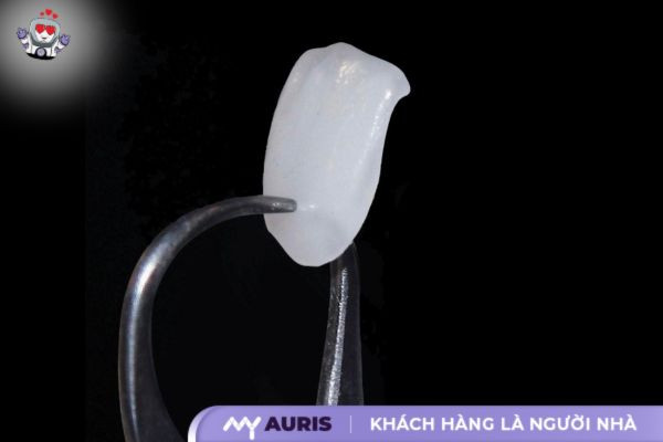 cách phân biệt các loại răng sứ