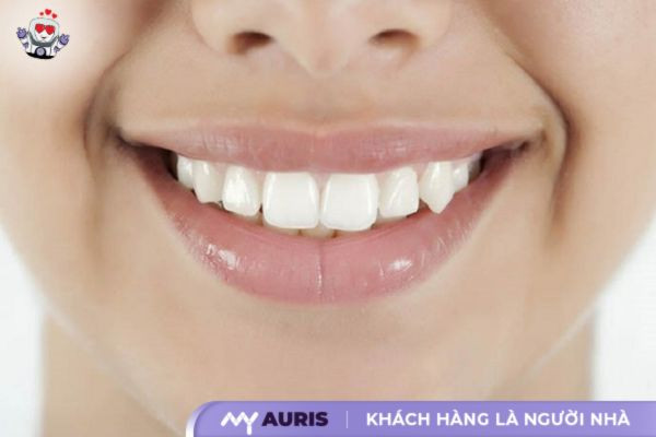 cách trồng răng khểnh