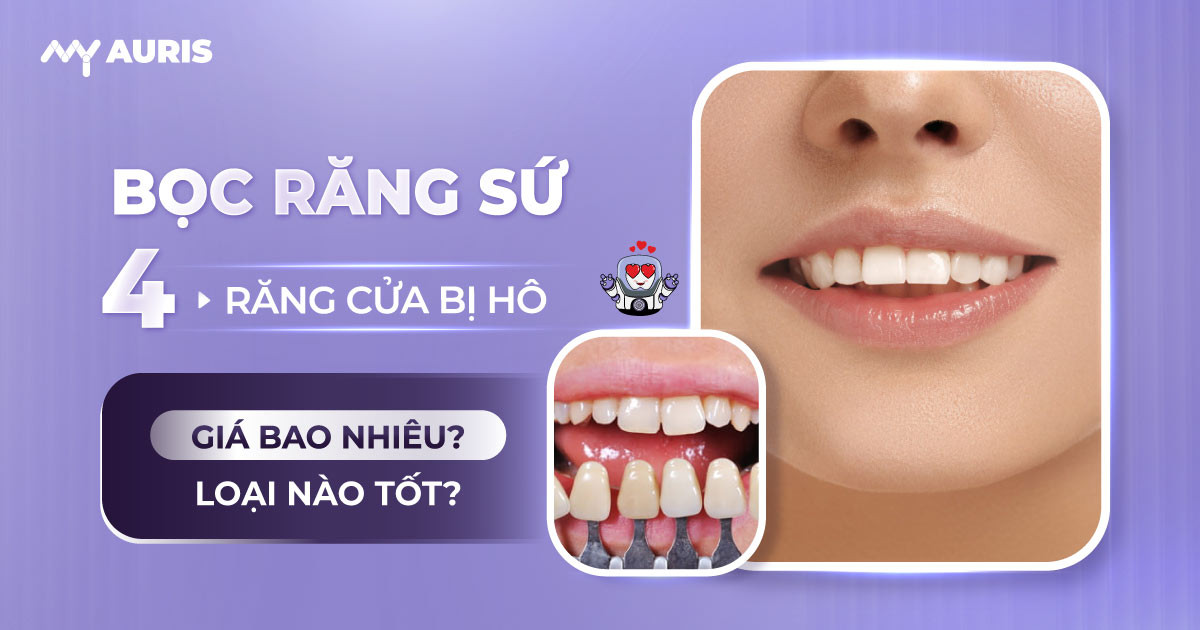 Bọc răng sứ cho 4 răng cửa bị hô