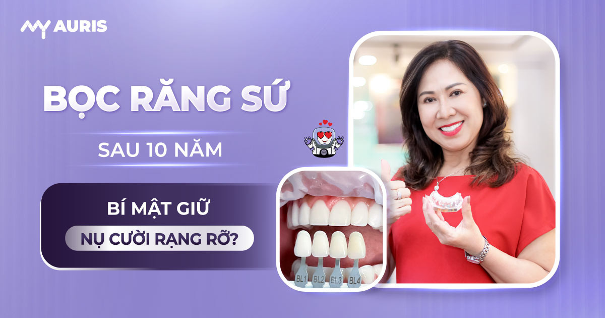 bọc răng sứ sau 10 năm