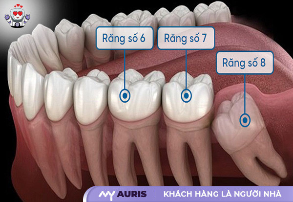 bọc sứ răng số 7 bao nhiêu tiền,bọc sứ răng số 7