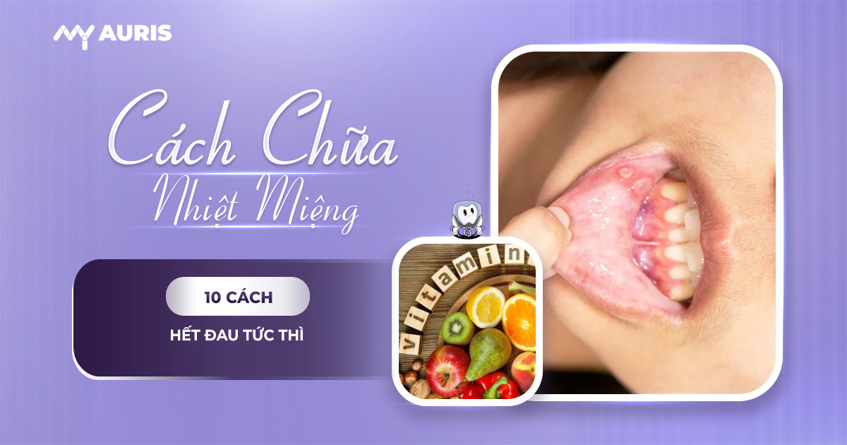 cách chữa nhiệt miệng,cách chữa nhiệt miệng nhanh nhất