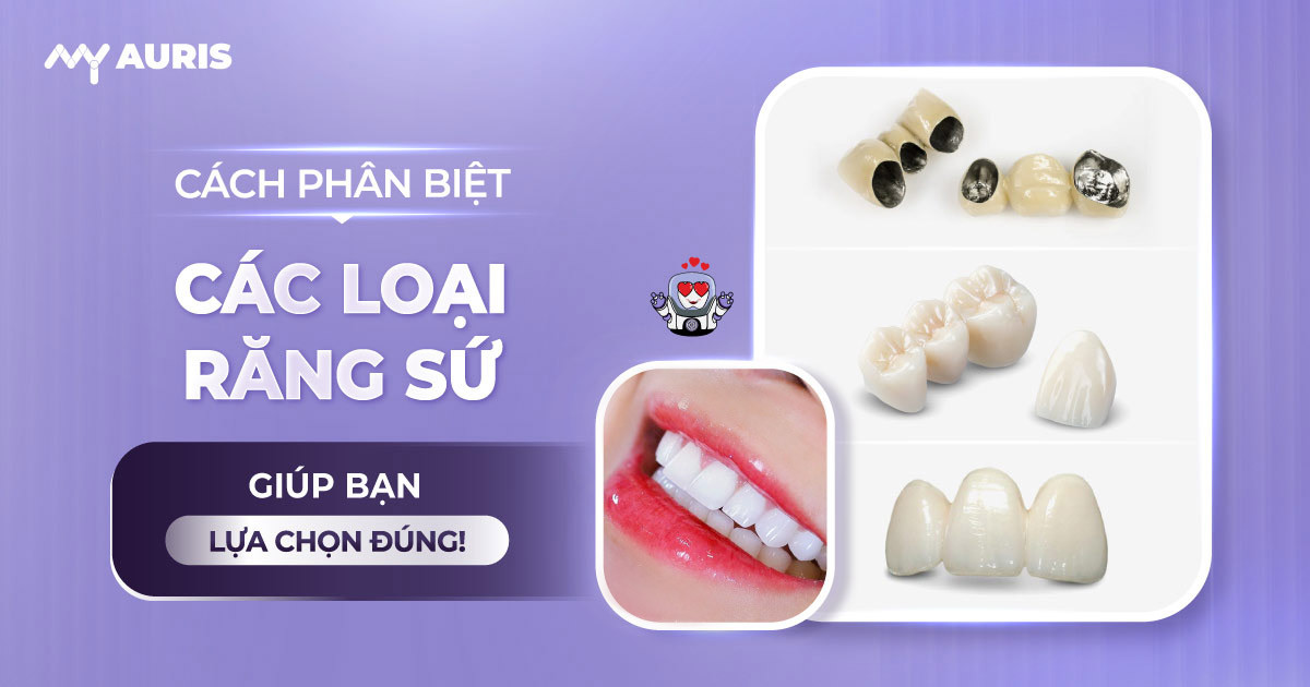 cách phân biệt các loại răng sứ