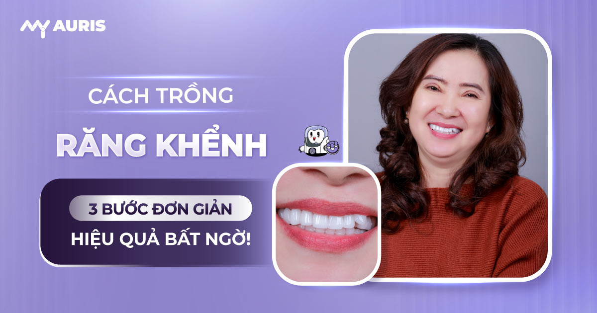 cách trồng răng khểnh