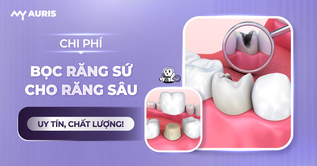 chi phí bọc răng sứ cho răng sâu