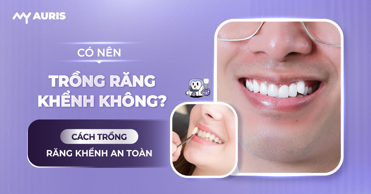 có nên trồng răng khểnh không