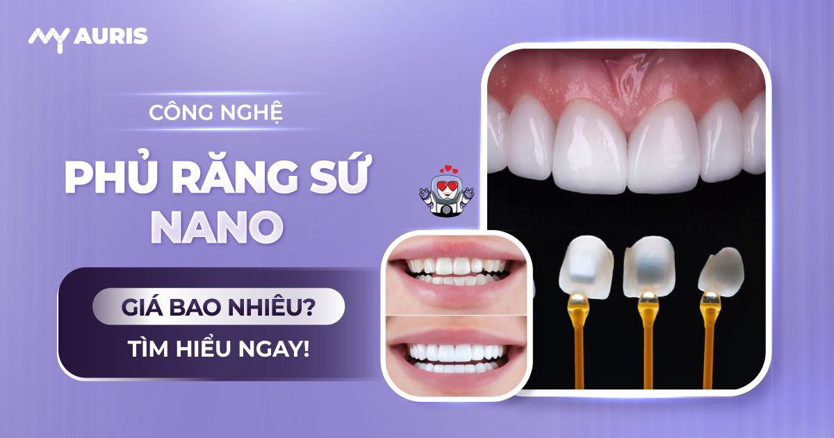 công nghệ phủ răng sứ nano giá bao nhiêu