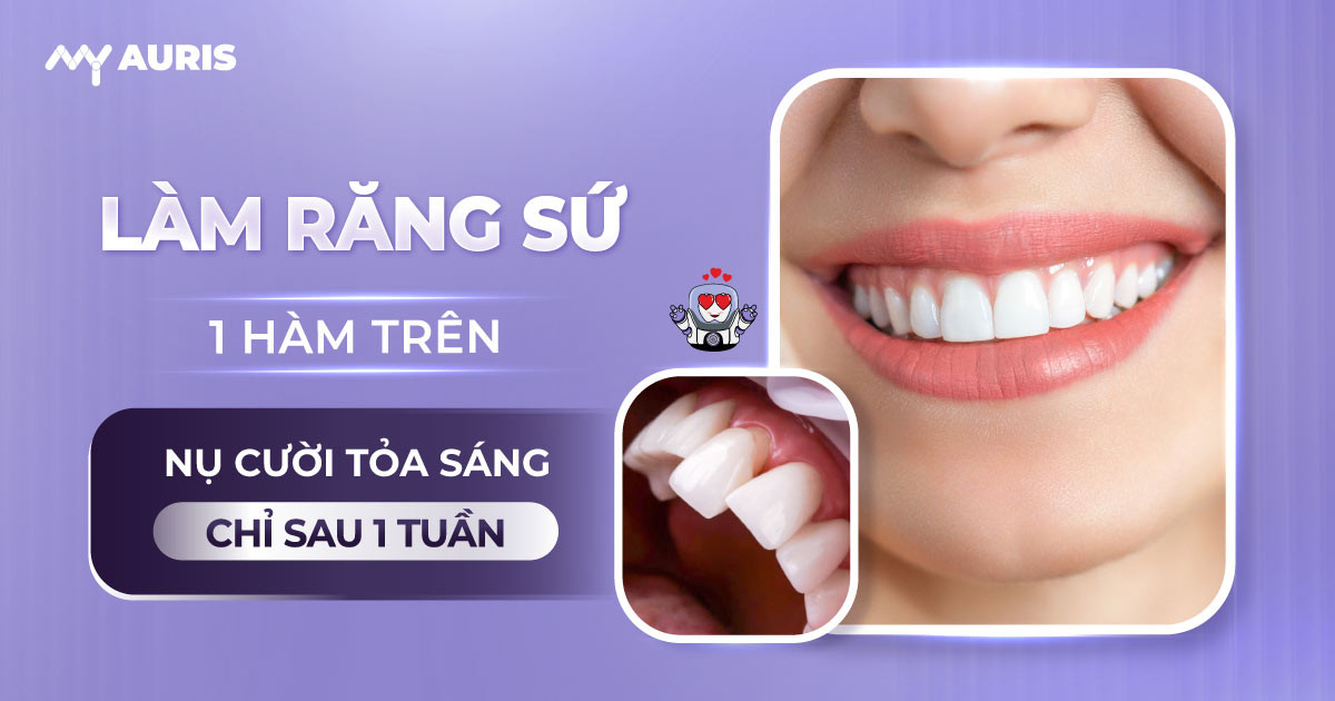 làm răng sứ 1 hàm trên