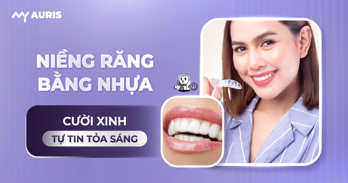 niềng răng bằng nhựa