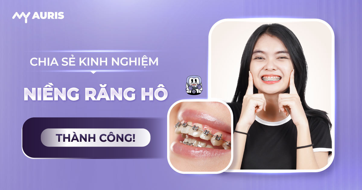 niềng răng hô thành công