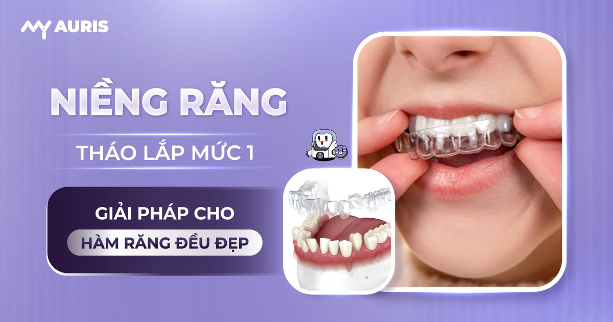 niềng răng tháo lắp mức 1