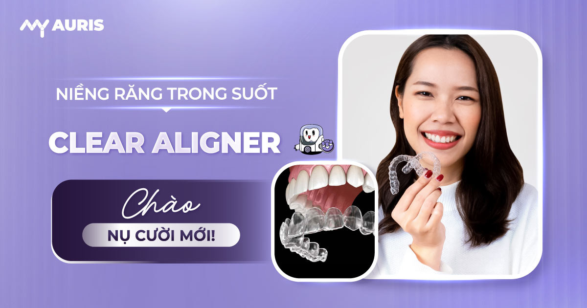 niềng răng trong suốt clear aligner