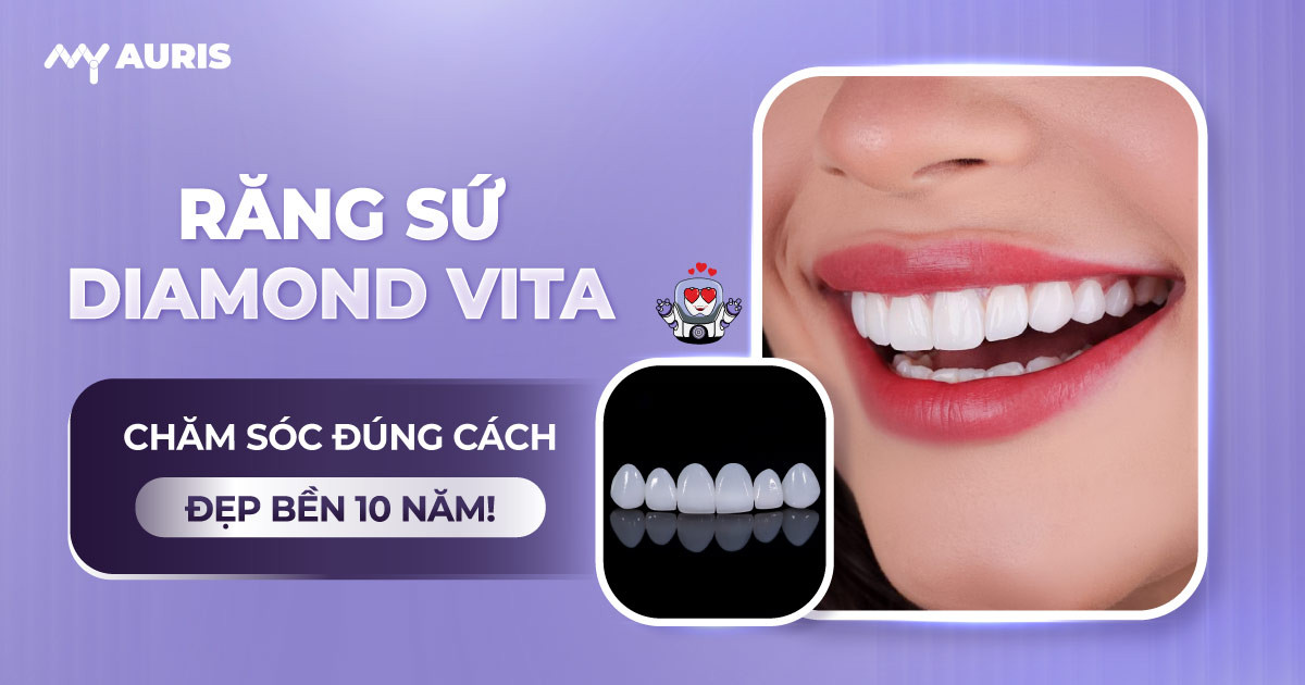 răng sứ diamond vita