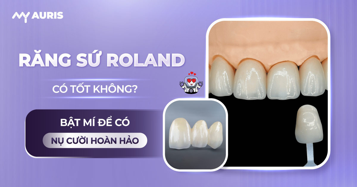 răng sứ roland có tốt không