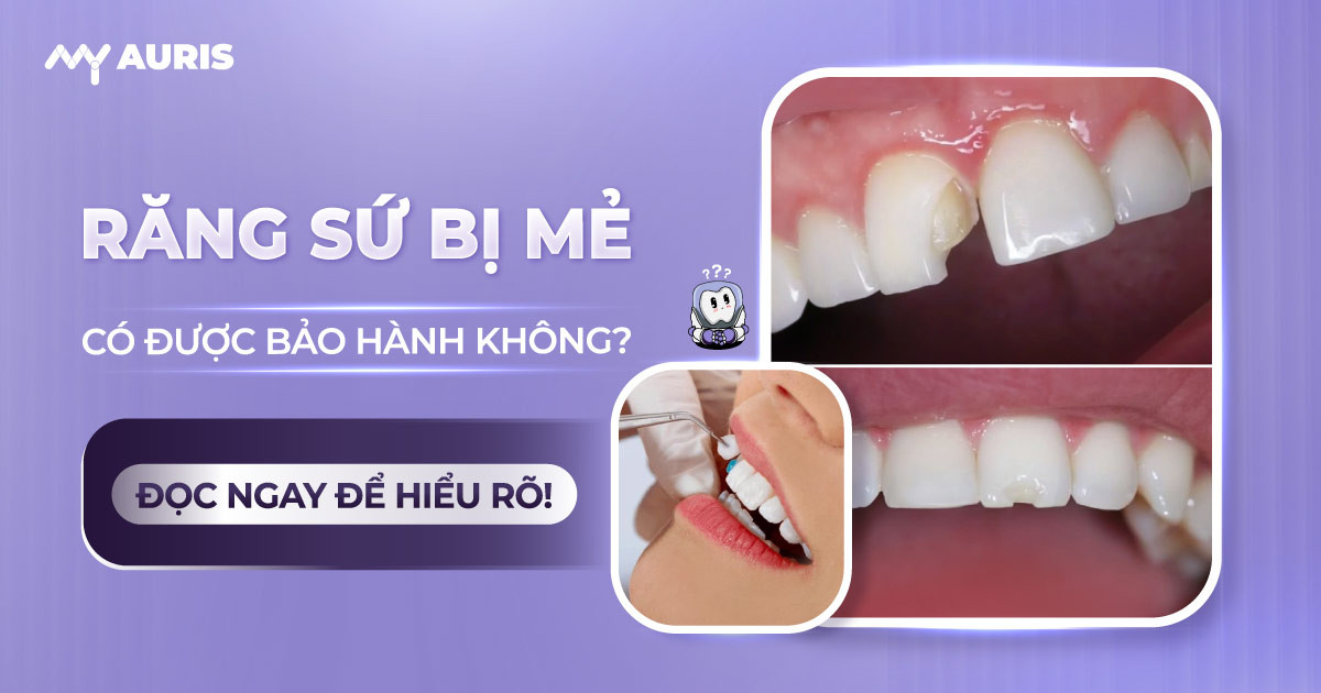 răng sứ bị mẻ có được bảo hành không