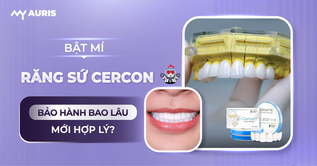 răng sứ cercon bảo hành bao lâu