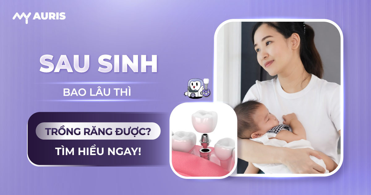 sau sinh bao lâu thì trồng răng được