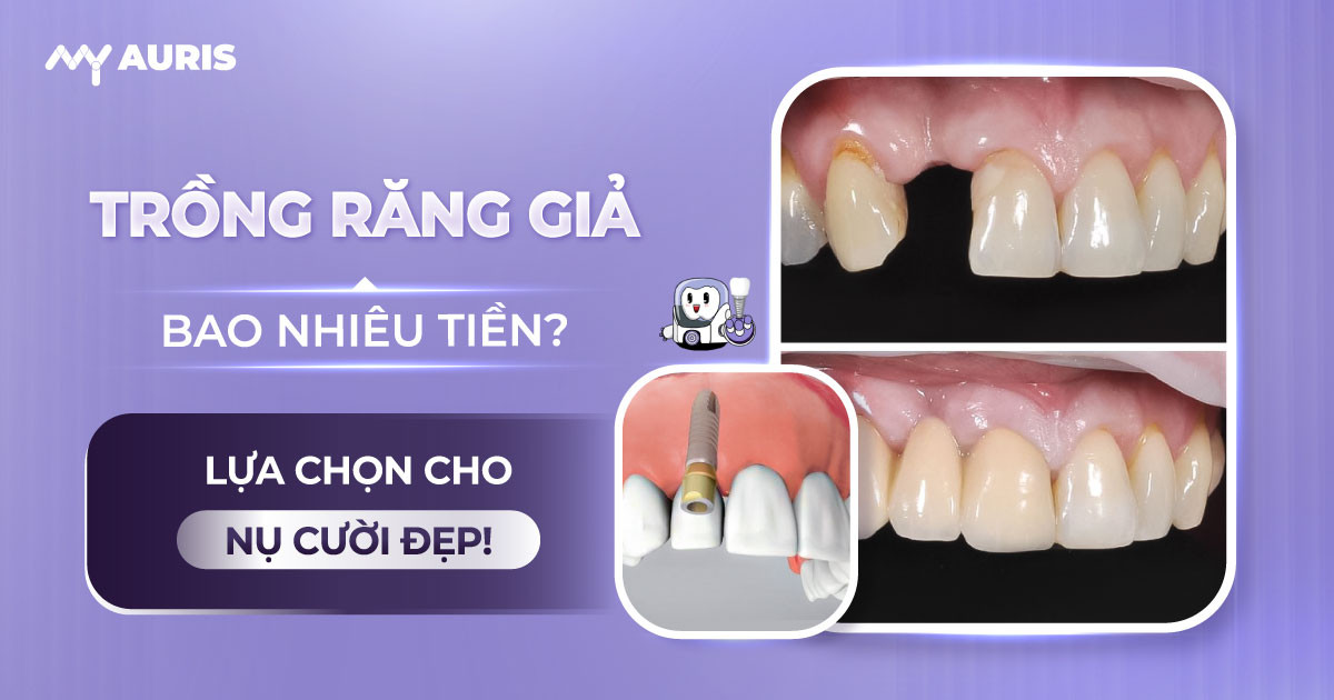 trồng răng giả bao nhiêu tiền