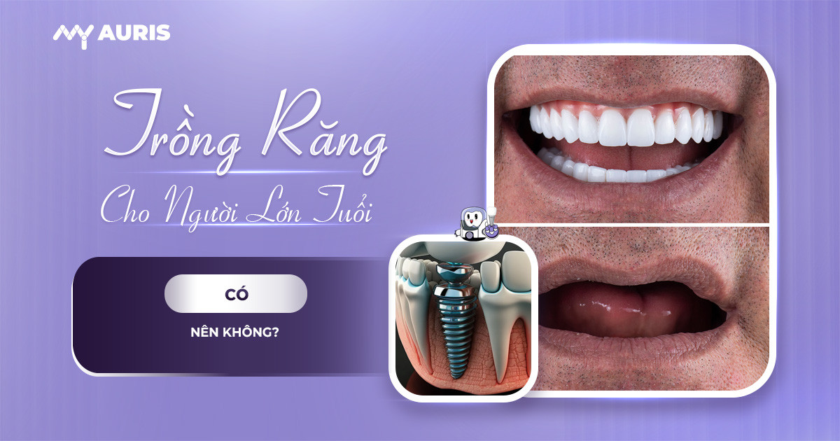 Trồng răng cho người lớn tuổi